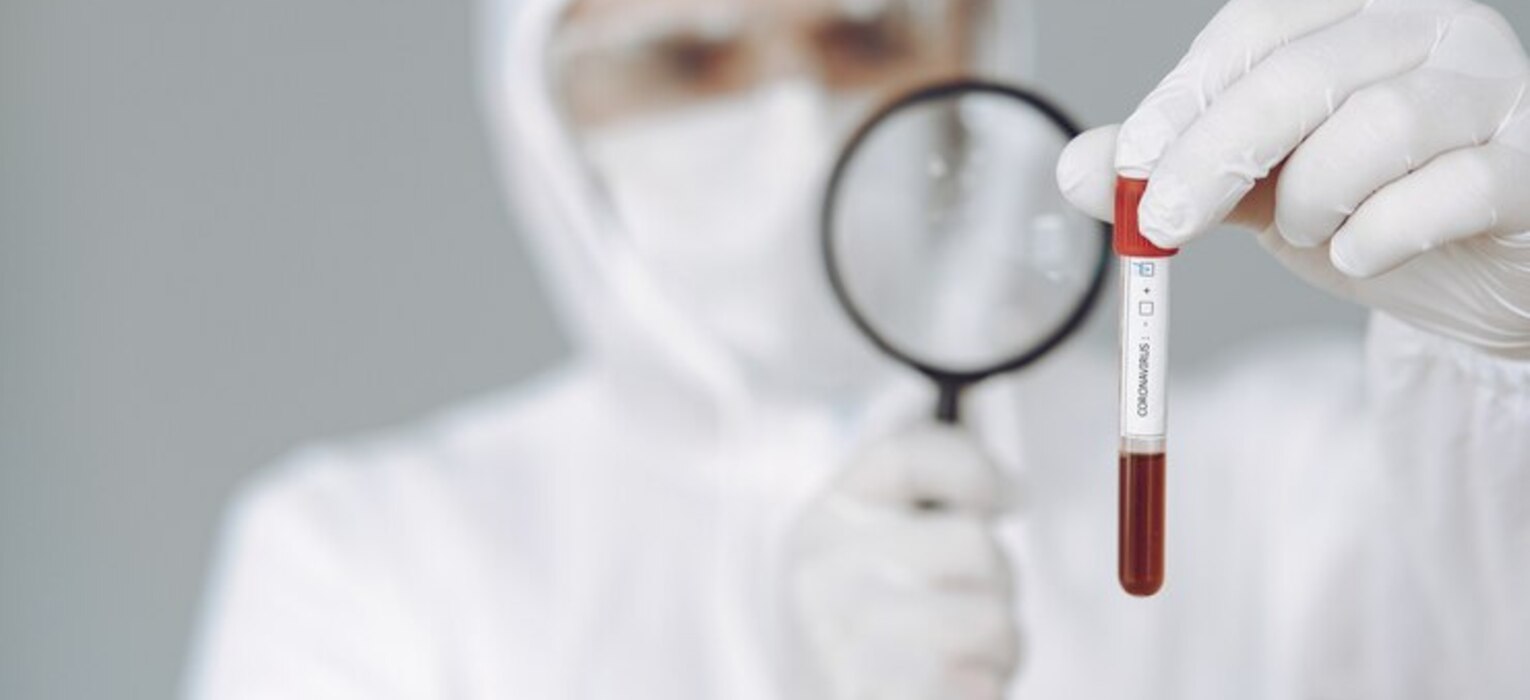 Bloodborne Pathogens (BBP)